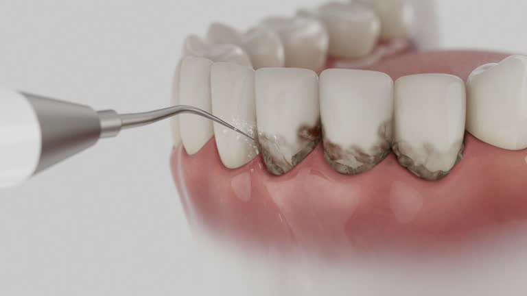 Trusted Tooth Extraction service in Park Hills, KY - Dentist Open Now